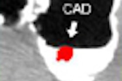 2008 07 29 11 21 52 52 Nappi thumb 08 08