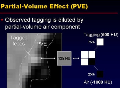 2008 07 29 11 21 53 470 Nappi pve complications