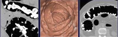 2008 07 29 11 21 54 79 Nappi laxfreevc