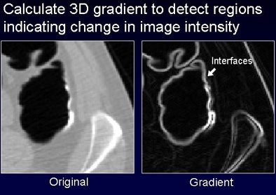 2008 07 29 11 21 59 720 Nappi below pvinterface