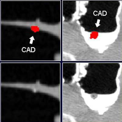2008 07 29 11 22 00 974 Nappi beforeandafter