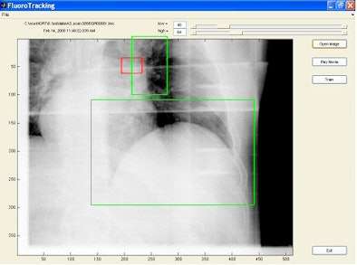 2008 08 07 14 11 14 165 Flouro Tracking Image Resized