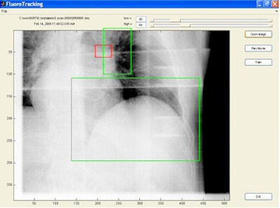 2008 08 07 14 11 14 165 Flouro Tracking Image Resized