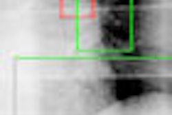 2008 08 07 14 11 14 757 Flouro Tracking Image Thumb