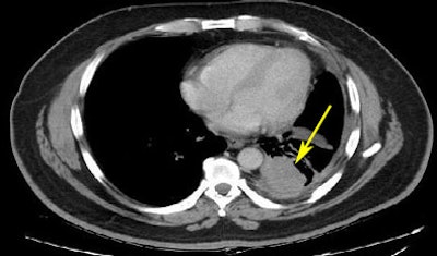 2008 08 07 15 16 13 635 Mcnitt riderprerxmarked