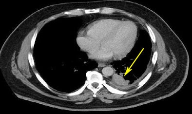 2008 08 07 15 16 13 903 Mcnitt riderpostrxmarked