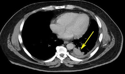 2008 08 07 15 16 13 903 Mcnitt riderpostrxmarked