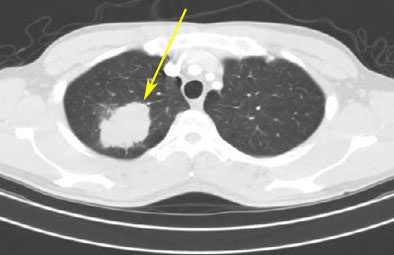 2008 08 07 15 16 14 279 Mcnitt lid Cnodulemarked