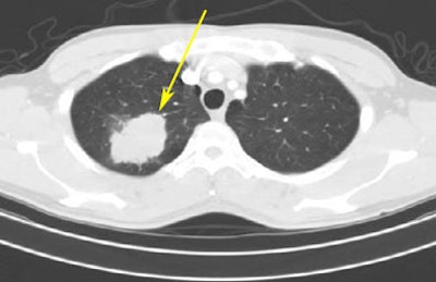 2008 08 07 15 16 14 279 Mcnitt lid Cnodulemarked