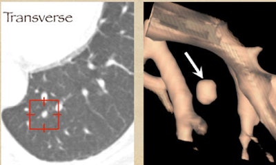 2008 08 11 13 50 34 660 Rubin multiplanarvalue