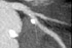 2008 08 18 10 17 07 0 Shuman thumb 08 08