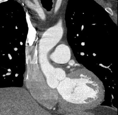 2008 08 18 10 17 09 889 Shuman cardopac3