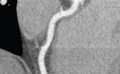 2008 08 18 10 17 10 314 Shuman cardopac2