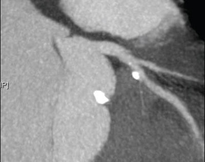 2008 08 18 10 17 11 684 Shuman cardopac1