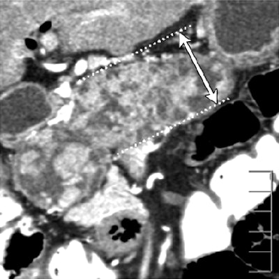 2008 08 19 14 02 09 181 Ogawa bottom