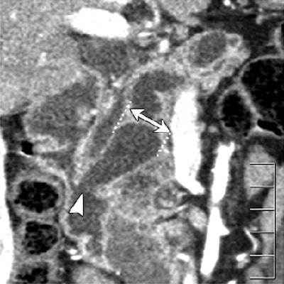 2008 08 19 14 02 13 95 Ogawa below