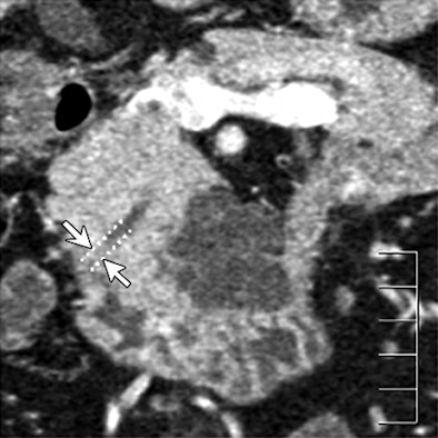 2008 08 19 14 02 17 959 Ogawa top