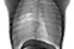 2008 08 21 12 08 52 159 Chest Ap 1 Thumb