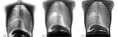 2008 08 21 12 14 21 199 Chest Ap 1 Resized2