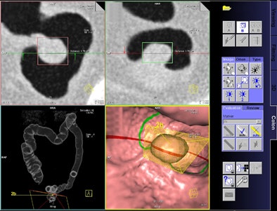 2008 08 25 12 37 20 511 Bielen fig3