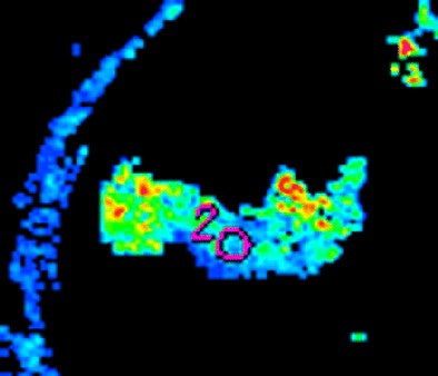 2008 08 25 14 58 42 671 Goh1cbottom Resized