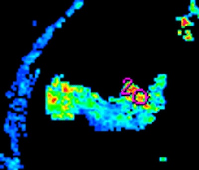 2008 08 25 14 58 43 455 Goh1bmiddle Resized