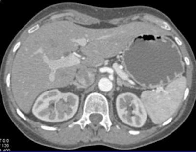 2008 08 27 15 54 24 158 Fishman tcctop