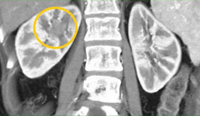 2008 08 27 15 54 26 189 Fishman tccbottom