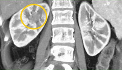 2008 08 27 15 54 26 189 Fishman tccbottom