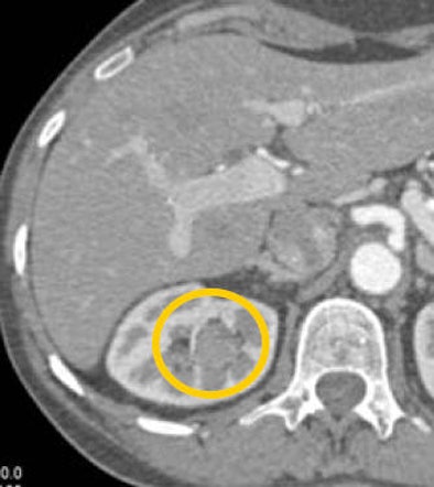 2008 08 27 15 54 29 392 Fishman tccbelow