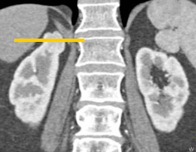 2008 08 27 15 54 33 149 Fishman multiplanartop