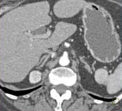 2008 08 27 15 54 35 341 Fishman multiplanarbottom