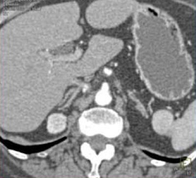 2008 08 27 15 54 35 341 Fishman multiplanarbottom