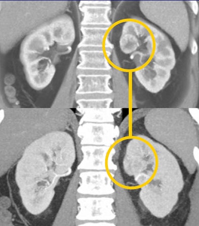 2008 08 27 15 54 37 474 Fishman mipvr