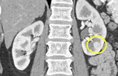 2008 08 27 16 00 00 370 Subtlerctbottom Resized