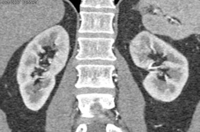 2008 08 27 16 00 01 489 Subtlercttop Resized