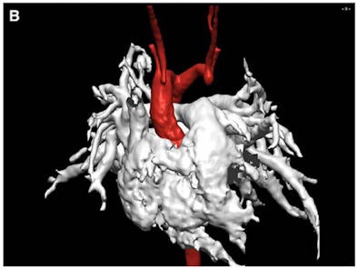 2008 08 28 14 18 34 479 Ped Mri B