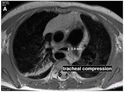 2008 08 28 14 18 35 601 Ped Mri A