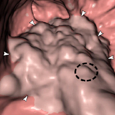 2008 09 04 13 37 03 633 Park4a