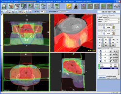 2008 09 05 13 54 44 623 Netmeeting Prosoma
