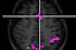 2008 09 05 15 21 18 419 2008 09 12 Fmri Multitasking Thumb pg