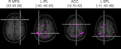 2008 09 05 15 21 19 705 2008 09 12 Fmri Multitasking Bottom