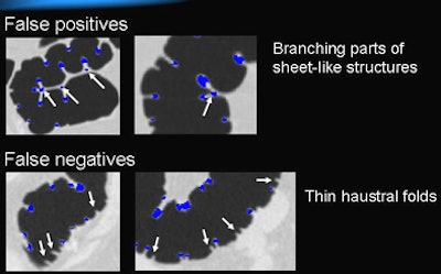 2008 09 08 16 44 58 963 Oda results2fp