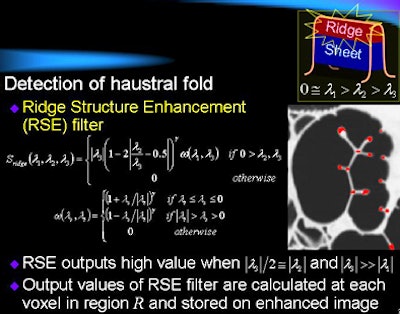 2008 09 08 16 45 05 327 Oda detectionbottom