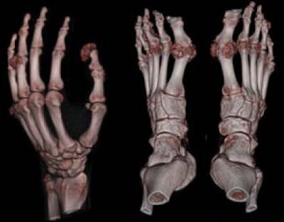 2008 09 09 14 01 09 589 Nicolaou subclinical