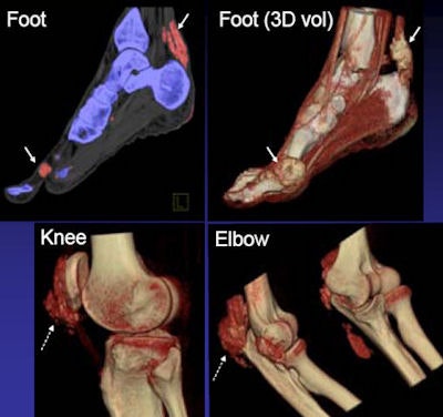 2008 09 09 14 01 09 854 Nicolaou tendonsligaments