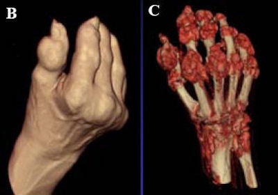 2008 09 09 14 01 10 236 Nicolaou hand dect