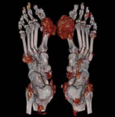 2008 09 09 14 01 12 881 Nicolaou feet Dect