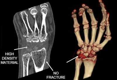 2008 09 09 14 01 14 173 Nicolaou wrist