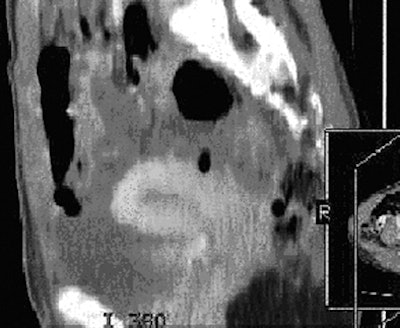 2008 09 16 13 13 46 877 2008 09 12 Ct Sensitivity 4 B Resized